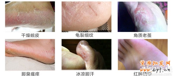 41.【亮鉆計(jì)劃】拒絕理由解析——涉及色情丑陋的解決方案